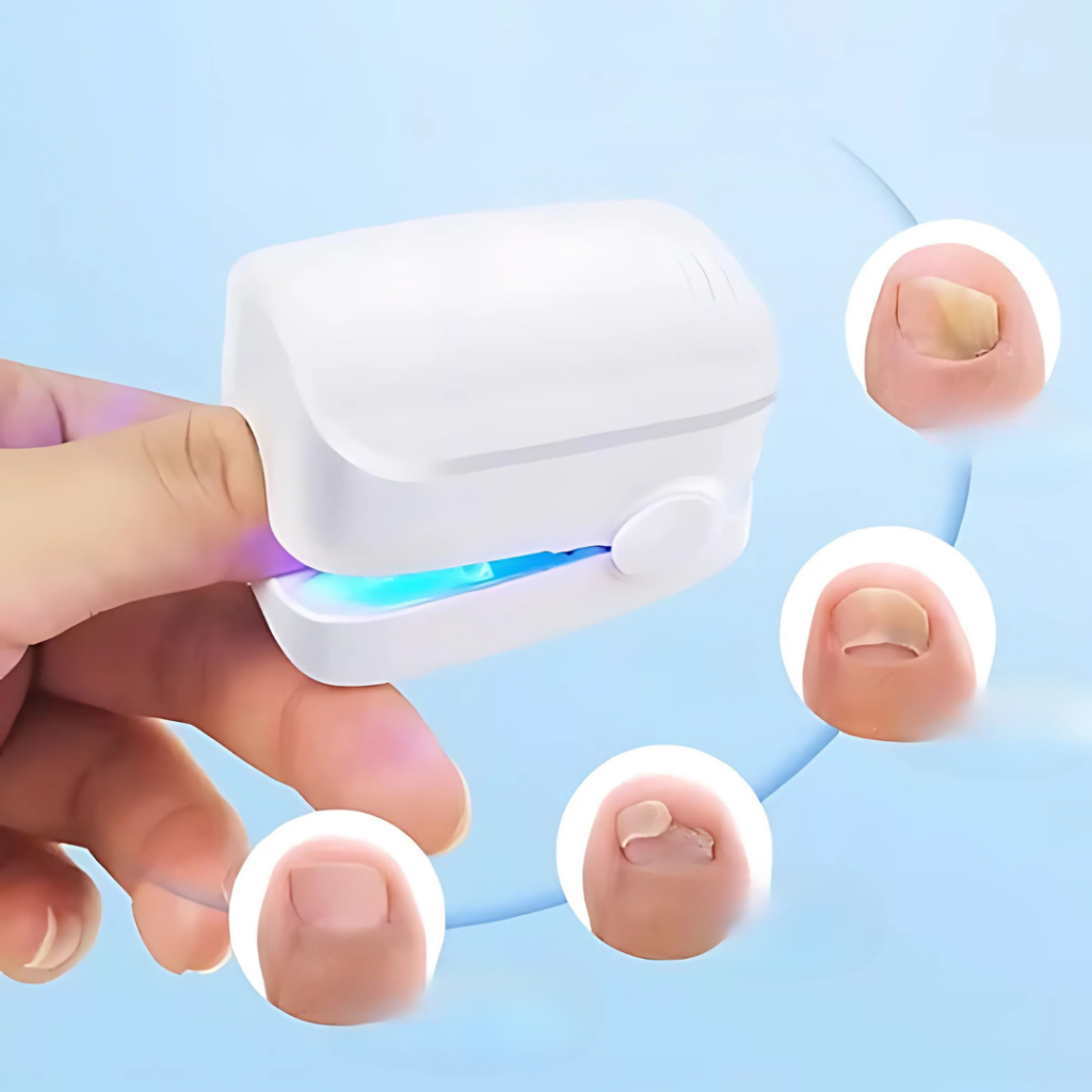 Dispositivo laser per il trattamento delle unghie per la cura delle infezioni fungine