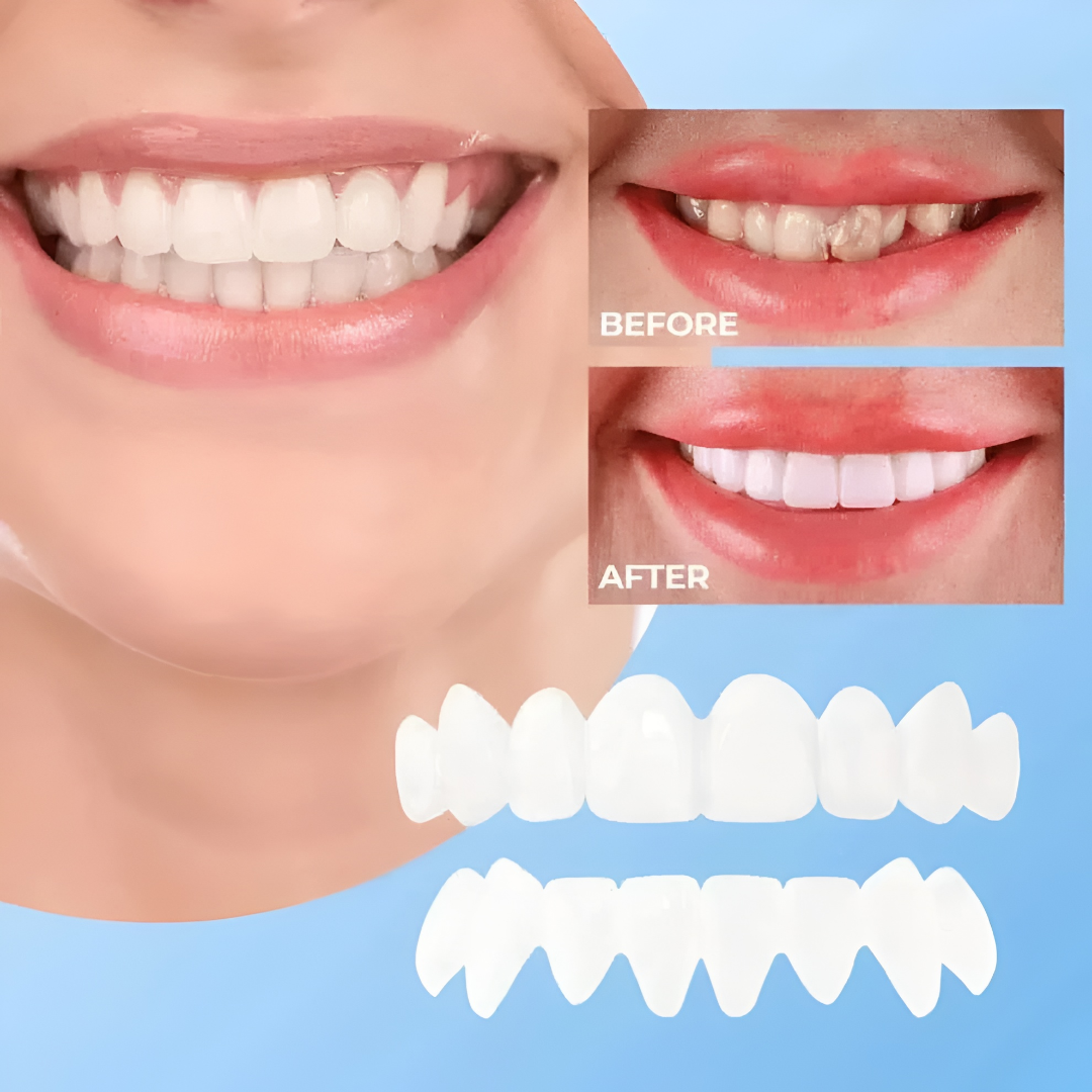 Carillas para dientes con acabado blanco natural