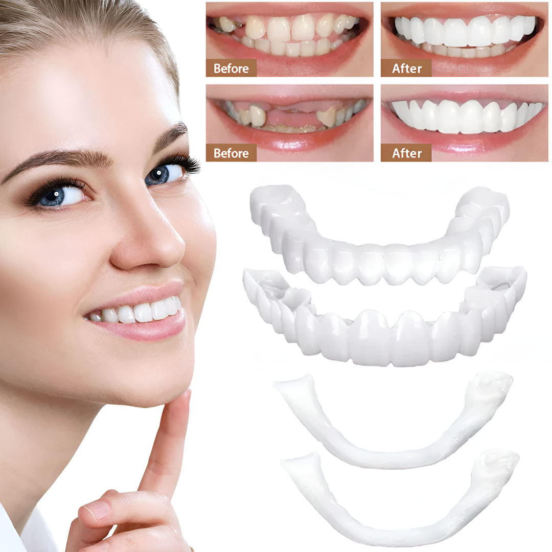 Carillas para dientes con acabado blanco natural